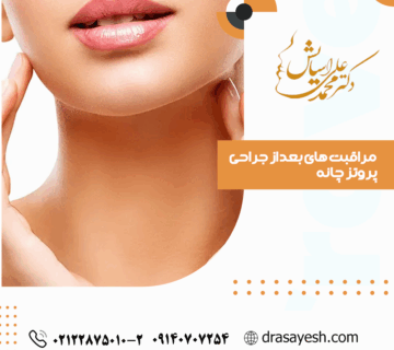 مراقبت های بعد از جراحی چانه