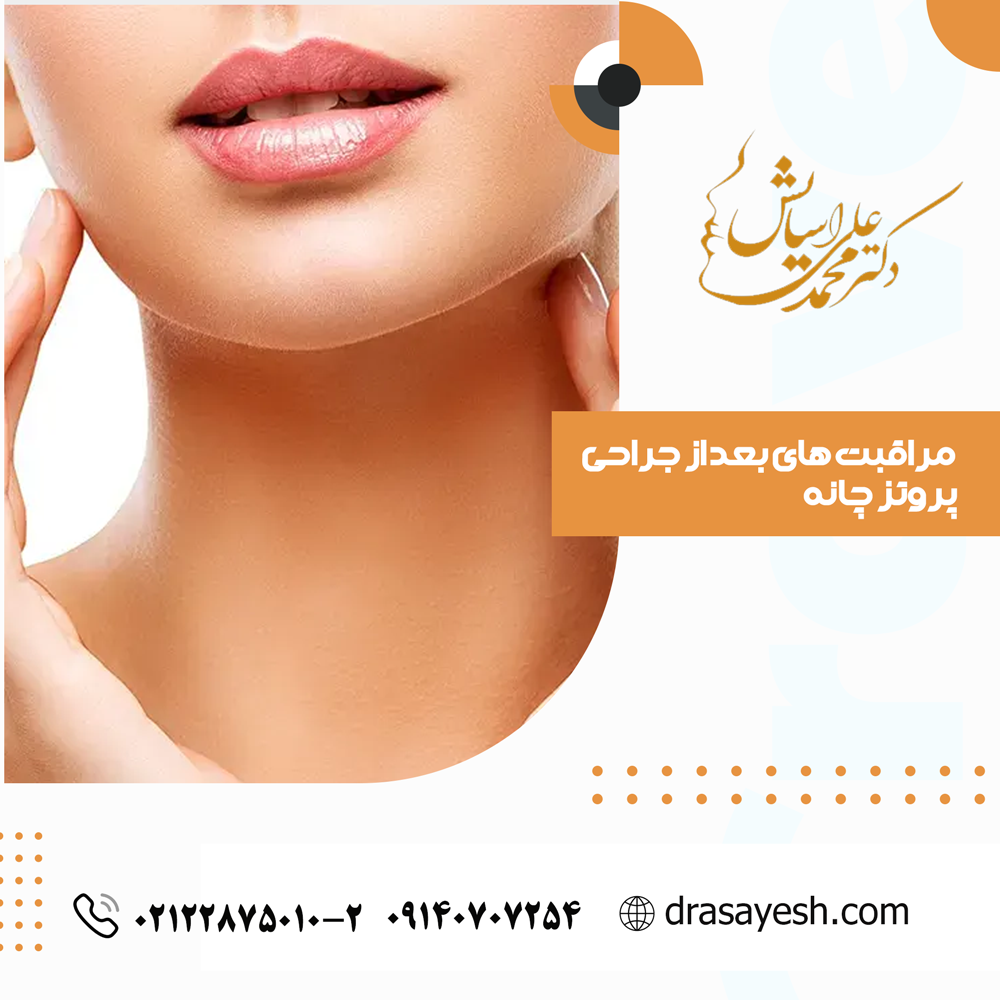 مراقبت های بعد از جراحی چانه