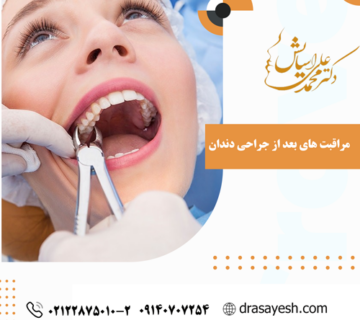 مراقبت های بعد از جراحی دندان