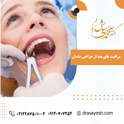 مراقبت های بعد از جراحی دندان