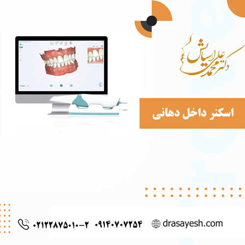 اسکنر داخل دهانی
