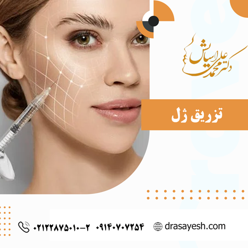 تزریق ژل - دکتر محمدعلی آسایش