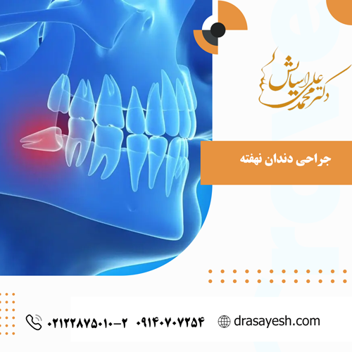جراحی دندان نهفته